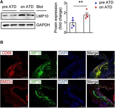 Deficiency of LMP10 Attenuates Diet-Induced Atherosclerosis by Inhibiting Macrophage Polarization and Inflammation in Apolipoprotein E Deficient Mice